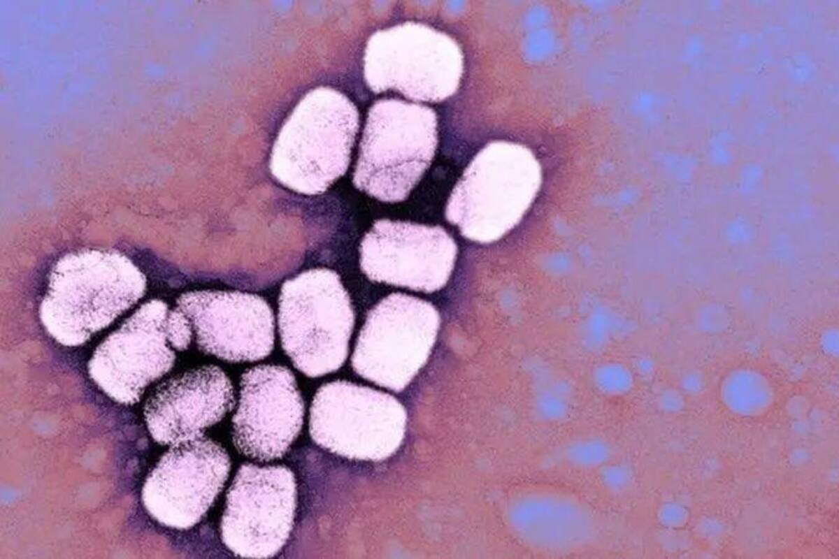 La viruela era causada por el virus variola.