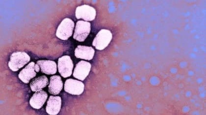La viruela era causada por el virus variola.