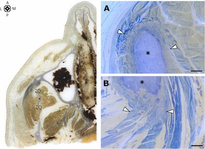 La vista inferior de una sección transversal incrustada en MMA, que muestra las entesis del músculo temporal y la parte coronoide del masetero en la apófisis coronoides