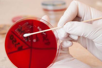 Laboratorio; Meningitis; vacuna; enfermedad; Salud; Sociedad