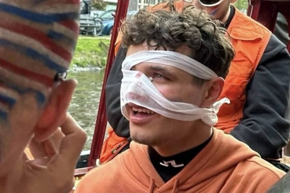 Lando Norris, con una venda precaria y lesionado en la nariz