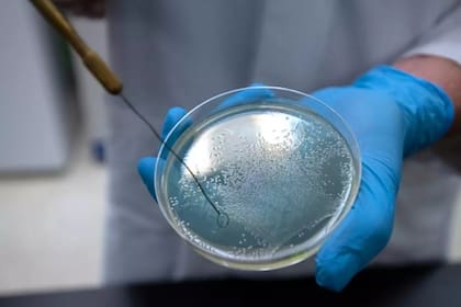 Las aflatoxinas que despiden los mohos pueden provocar efectos crónicos como la aparición de cáncer, afirman expertos