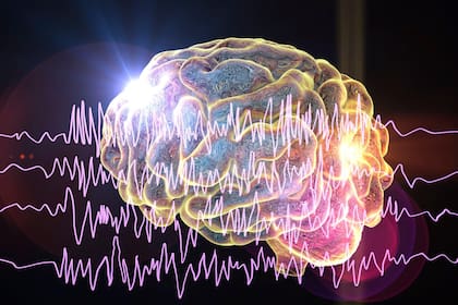 Las ataques de epilepsia son provocados por ráfagas anormales de actividad eléctrica en el cerebro, las cuales provocan que el cuerpo se mueva sin control.