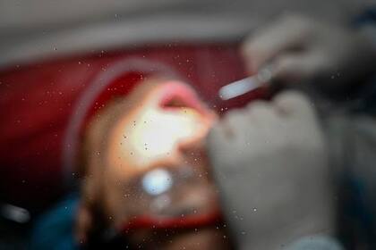 Las bacterias dañinas descomponen los azúcares de los alimentos y las bebidas y los convierten en ácidos
