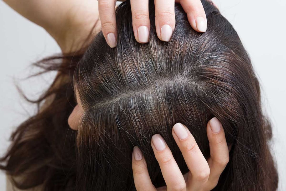 Las canas en las personas jóvenes pueden aparecer por una mala alimentación o estrés (imagen ilustrativa)