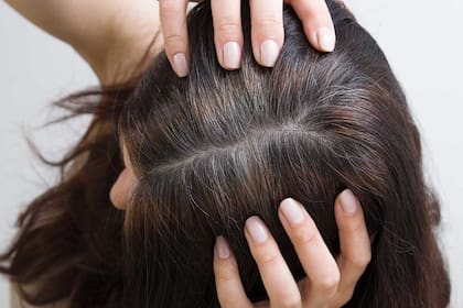 Las canas en las personas jóvenes pueden aparecer por una mala alimentación o estrés (imagen ilustrativa)