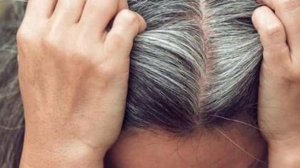 Las canas pueden aparecer por diversos factores, desde estrés hasta como signo de envejecimiento