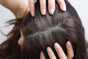 Las canas son cabellos que perdieron su pigmentación, volviéndose blancos o grises
