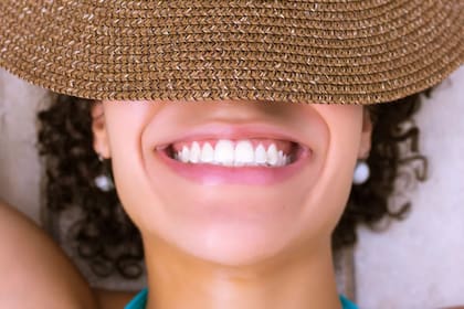 Las carillas y el diseño de sonrisa se volvieron furor tras la influencia de varias celebridades