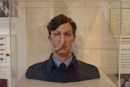 Las cirugías pioneras de Archibald McIndoe cambiaron la vida a decenas de pilotos desfigurados en combate