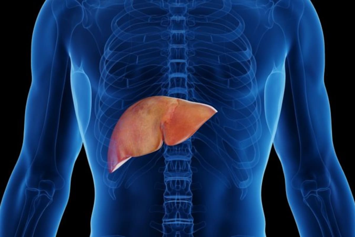 Las dietas ricas en carbohidratos refinados y grasas saturadas elevan el riesgo de progresión hacia enfermedades más graves como fibrosis o cirrosis, debido a su efecto en el hígado y en el sistema metabólico