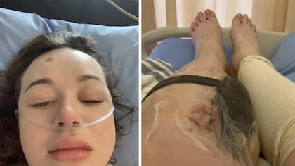 Las diferentes intervenciones quirúrgicas evitaron la amputación de ambas piernas.
Foto: Facebook: julialauren