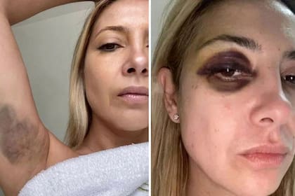 Las fotos de Fabiola Yañez con las que denunció a Alberto Fernández