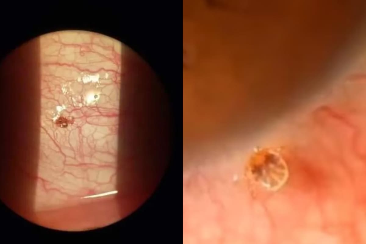 Las garrapatas son parásitos temporales que se alimentan de la sangre de los vertebrados. (Foto: TikTok: @neuquencapitaltiktok)