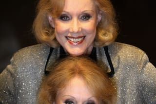 Las gemelas Kessler, de Alemania, mueren a los 89 años