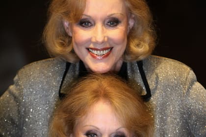 Las gemelas Kessler, de Alemania, mueren a los 89 años