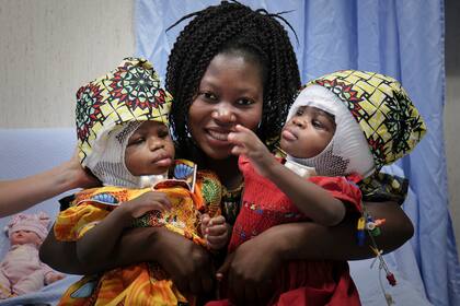 Las hermanas gemelas Ervina y Prefina con su madre después de una cirugía craneal exitosa en el hospital pediátrico del Niño Jesús (Bambino Gesu) en Roma