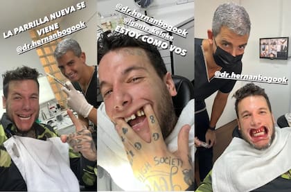 Las historias de Alex Caniggia en el odontólogo