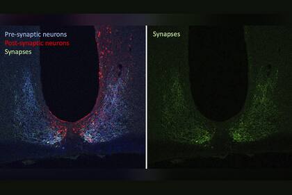 Las imágenes obtenidas de neuronas pre y post sinápticas del cerebro del ratón durante el estudio
