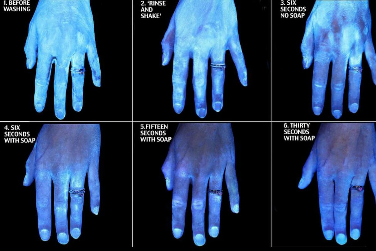 Las imágenes que demuestran lo importante que es el lavado de manos. Fuente: Reddit.