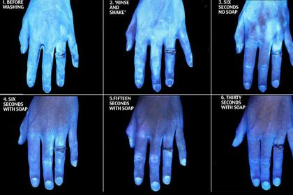 Las imágenes que demuestran lo importante que es el lavado de manos. Fuente: Reddit.