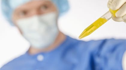 Las ITU pueden provocar fiebre, escalofríos, dolor en la parte baja del abdomen o la espalda, además de ardor al orinar