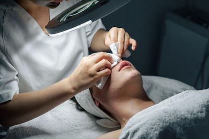 Las limpiezas consisten en estirpar los granos y las espinillas en condiciones adecuadas de asepsia y habiendo preparado la piel