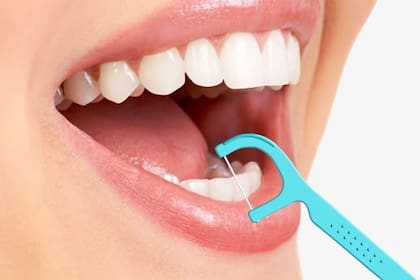 Las limpiezas dentales profundas deben realizarse con una frecuencia mínima de seis meses