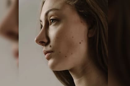 Las manchas en la piel pueden alertar sobre un problema de salud (Foto Pexels)