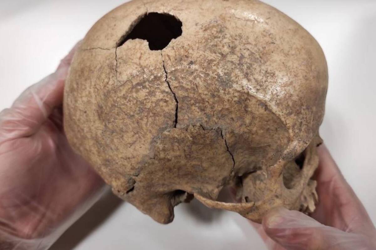 Las marcas halladas en el cráneo de un hombre que vivió en el período Neolítico permitieron a un grupo de científicos deducir la manera en que esta persona murió