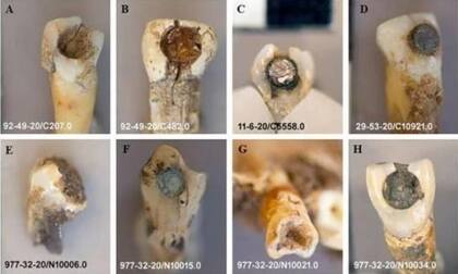 Las muestras de los dientes con jade incrustado recogidos por los arqueólogos