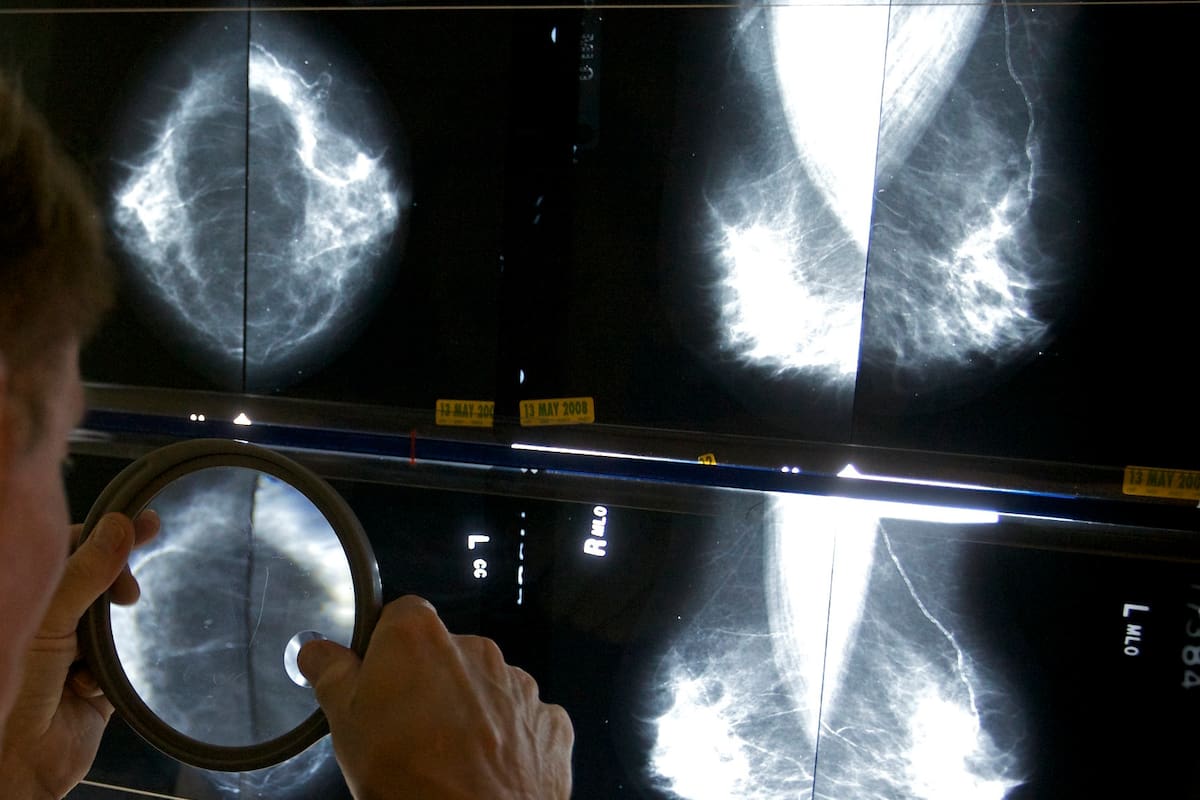 Las mujeres deben hacerse mamografías periódicas