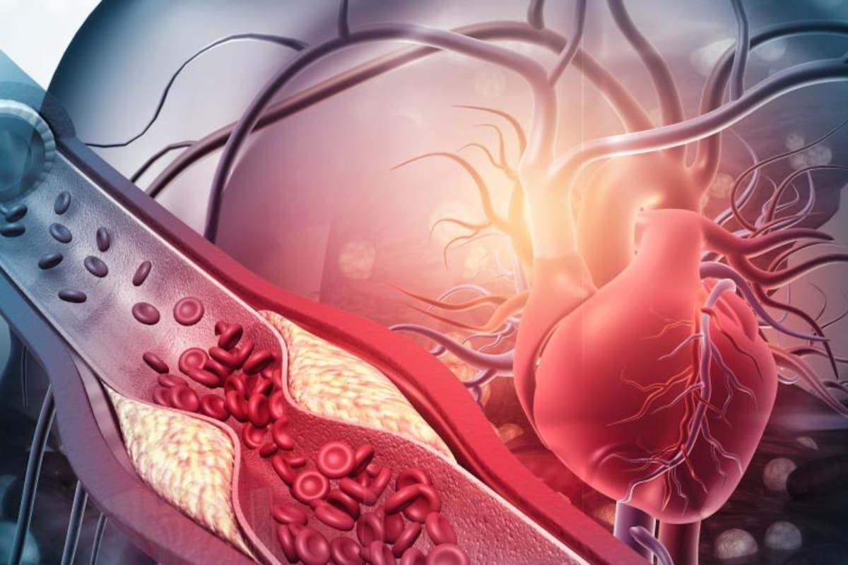 Las nuevas pautas ponen el foco en controles más tempranos del colesterol