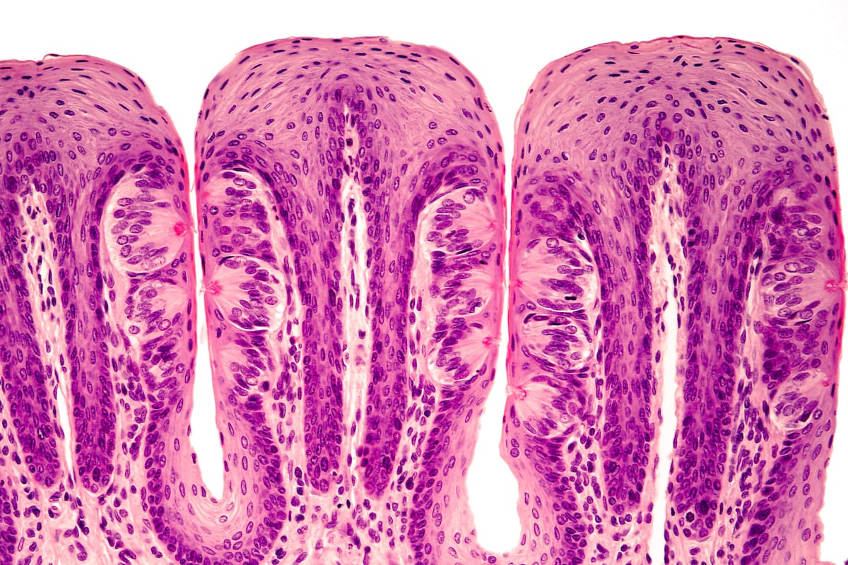 Las papilas gustativas