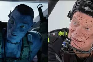 Las películas de la saga Avatar usaron sensores para capturar el movimiento de los actores y hacerlos parecer extraterrestres. Los científicos han adaptado la tecnología para rastrear la progresión de enfermedades.
