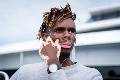 Las personas de piel oscura afectadas por vitiligo pueden sentir una pérdida de identidad cultural