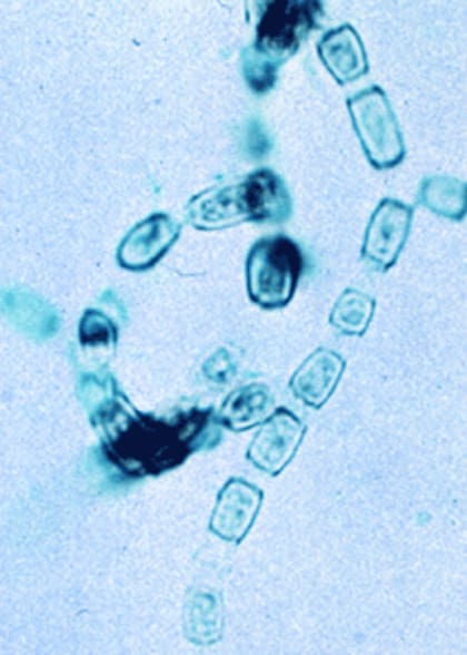 Las personas se contagian de Valley fever al inhalar esporas del hongo Coccidioides