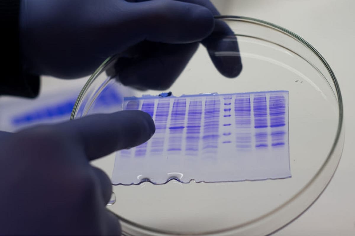 Las proteínas pasarían ahora a ensayos de laboratorio donde se comprobará su efecto antiviral