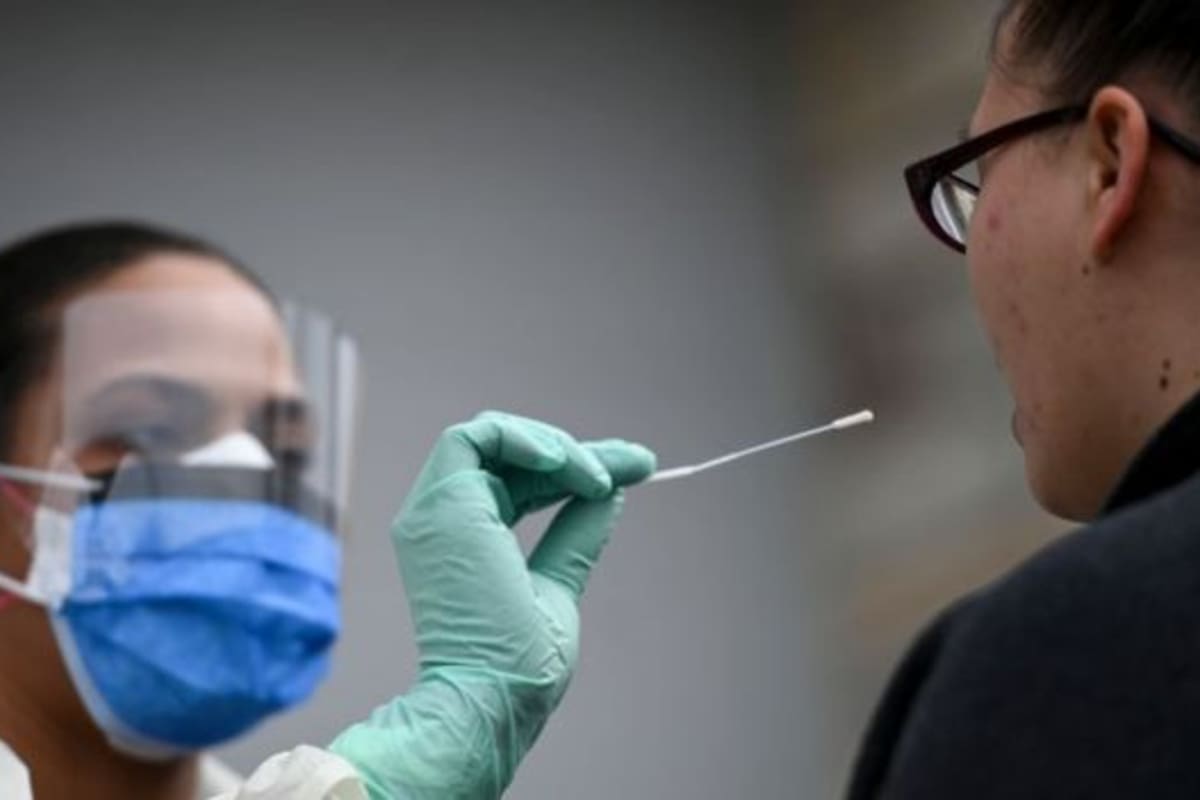 Las pruebas son el primer paso para contener la pandemia