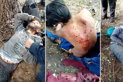 Las quemaduras en los cuerpos de los cosechadores del ajo, tras ser alcanzados por la descarga eléctrica del rayo.