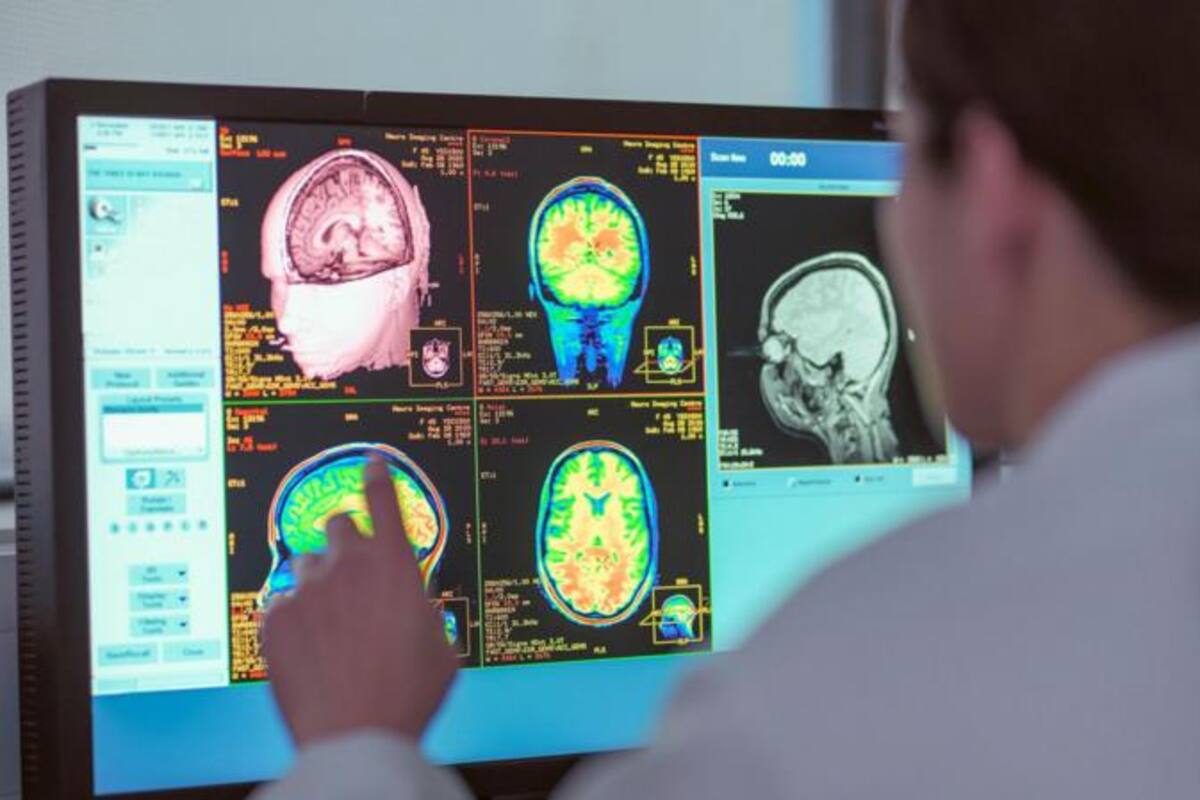 Las redes neuronales tienen cuatro puntos de inflexión a lo largo de la vida, según la investigación