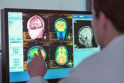 Las redes neuronales tienen cuatro puntos de inflexión a lo largo de la vida, según la investigación
