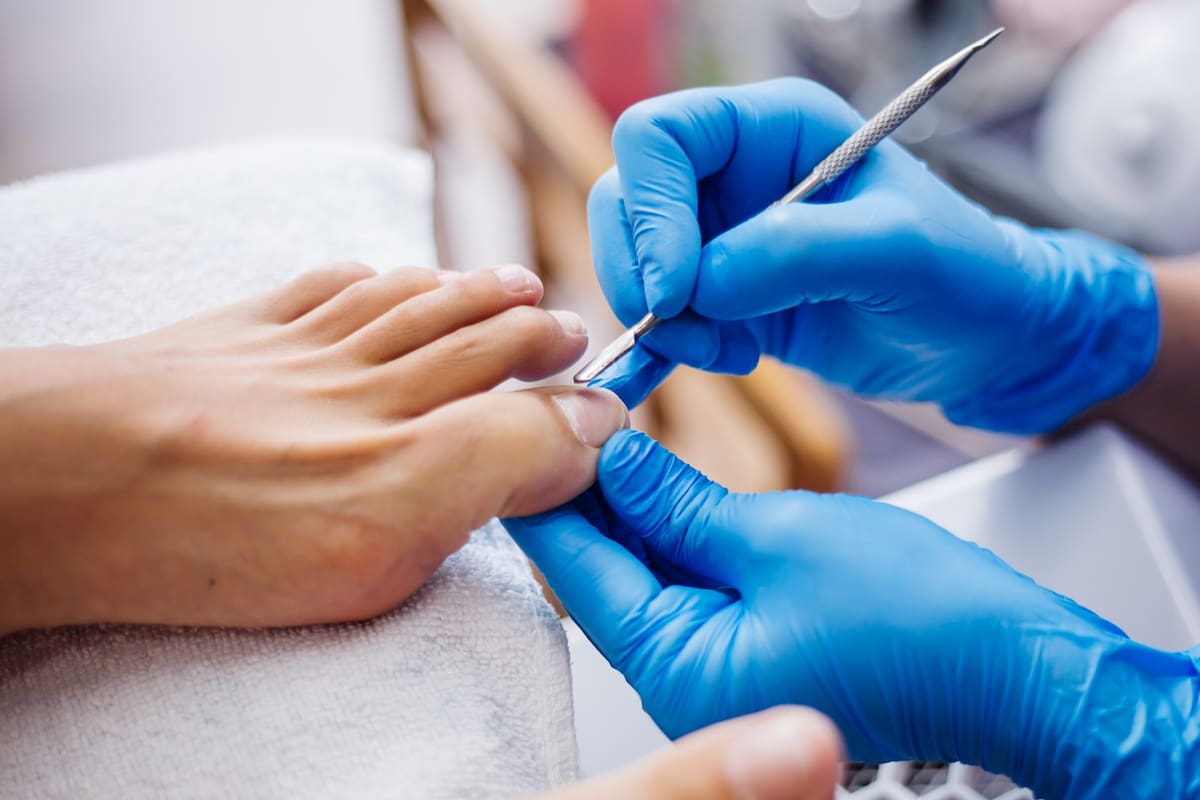 Las uñas encarnadas son una afección frecuente que se produce cuando la uña crece hacia adentro de la piel (Foto: Freepik)