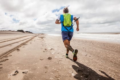 Las várices también afecta a los hombres