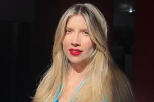Laurita Fernández reveló la enfermedad crónica que tiene (Foto Instagram @holasoylaurita)