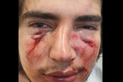 Lautaro Insúa, agredido por jóvenes rugbiers del club Tala cuando festejaba su egreso de la secundaria en una casa en un country de Córdoba