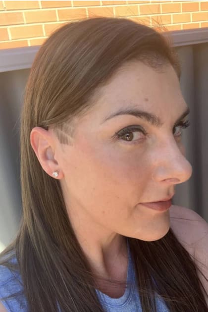 Lee King dejó atrás el problema del nevus azul pero nunca olvidará lo que hizo su amiga y estilista Ricci Jess por ella y asegura que "me salvó la vida"