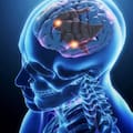 Deterioro cognitivo: estos son los cinco hábitos que hay que evitar para cuidar el cerebro