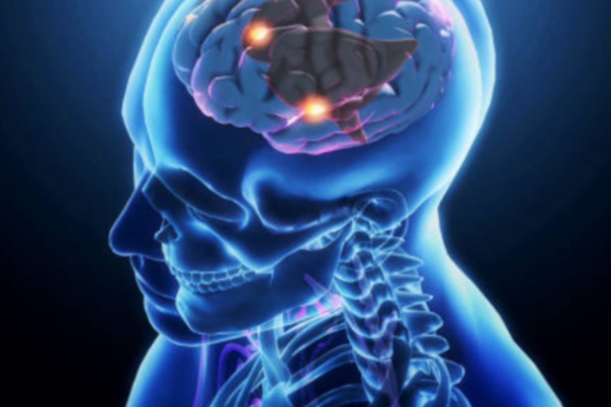 Leonardo Bello, neurólogo colombiano, advierte sobre las malas costumbres que atentan contra la salud cerebral