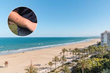 Leones marinos atacan personas en la costa de California.